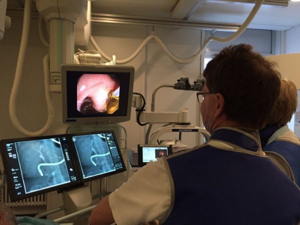 Ercp Darstellung Gallenwege Und Bauchspeicheldruse Gastroenterologie Bethanien Zurich